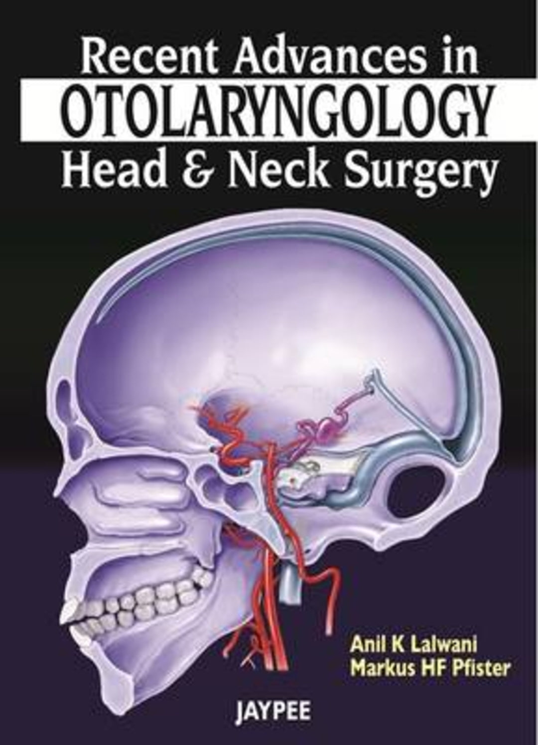 Cover image for Recent Advances in Otolaryngology - Head and Neck Surgery ISBN 9789350257906